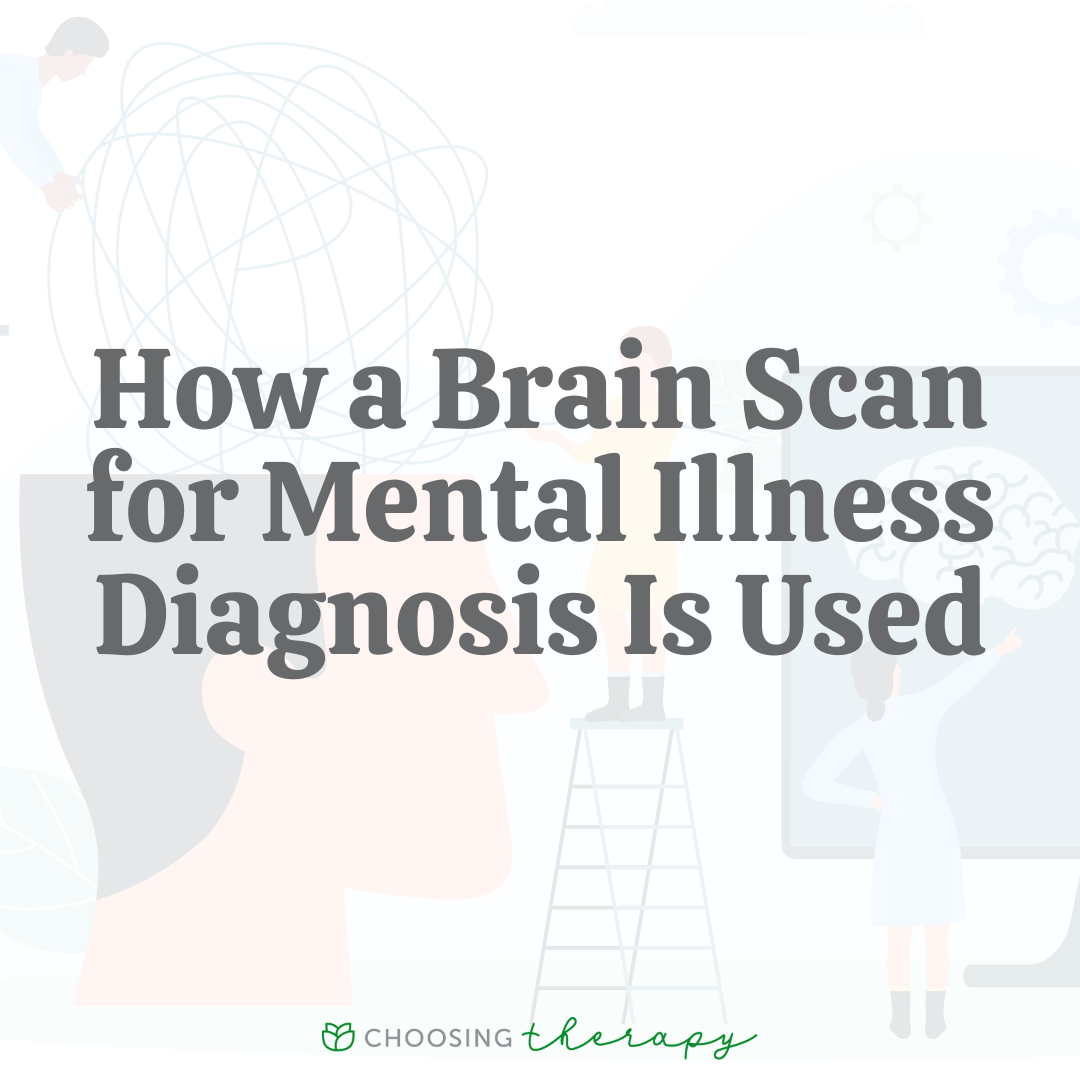 How Are Brain Scans Used To Diagnose Mental Illness 